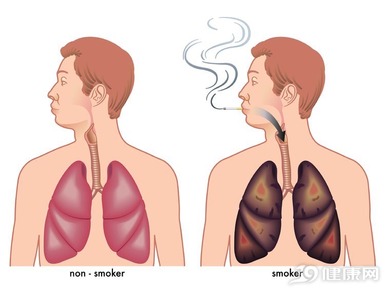 能让你快速戒烟的方法，数这3个最“猛”，成功的基本用过