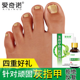 灰指甲专用抑菌液软甲脱甲膏正品治疗脚气止痒脱皮去烂脚丫甲沟炎