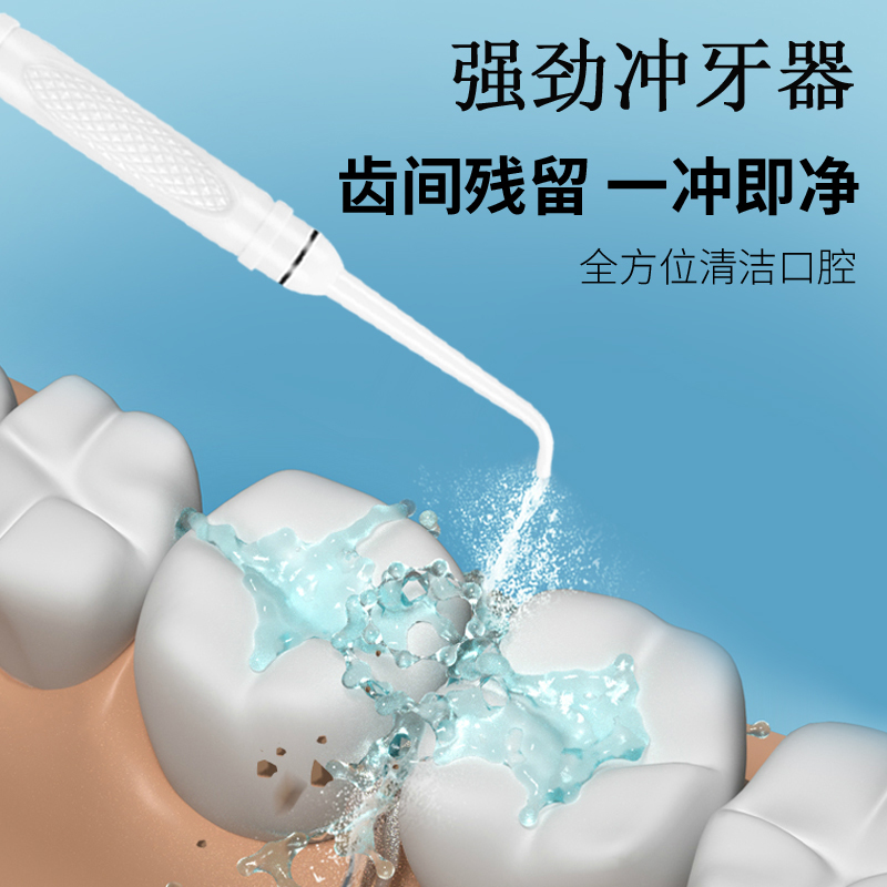 牙齿清洗冲牙器洗牙器家用口腔冲洗神器水龙头便携式水牙线洁牙器